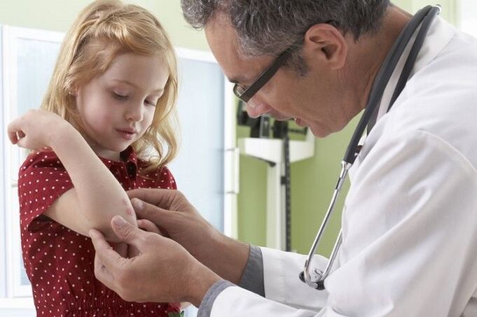 psoriasis op jonge leeftijd